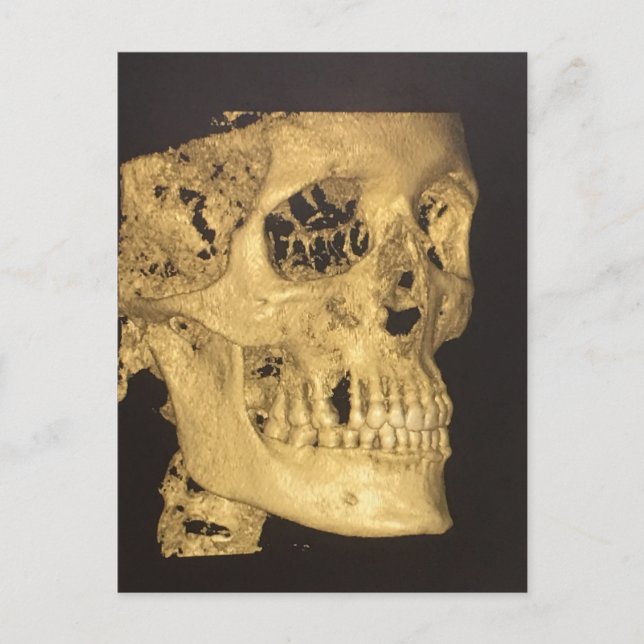 Scary Skull Postcard (Front)