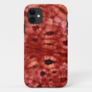 Sclerenchyma Cells from a Cherry Pit iPhone 11 Case