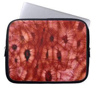 Sclerenchyma Cells from a Cherry Pit Laptop Sleeve