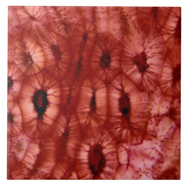 Sclerenchyma Cells from a Cherry Pit Tile (Front)