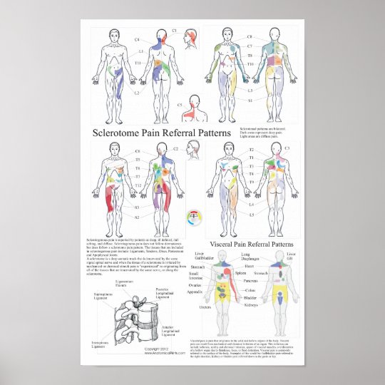 Visceral Referral Pattern Chart