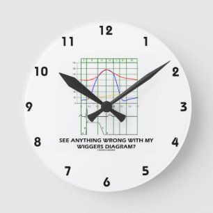 See Anything Wrong With My Wiggers Diagram? Round Clock