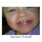 See that's 4 teeth!!