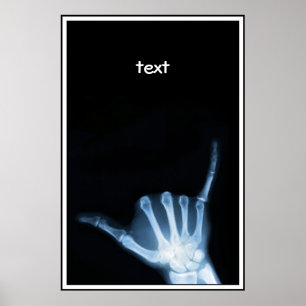 Shaka Sign X-Ray (Hang Loose)