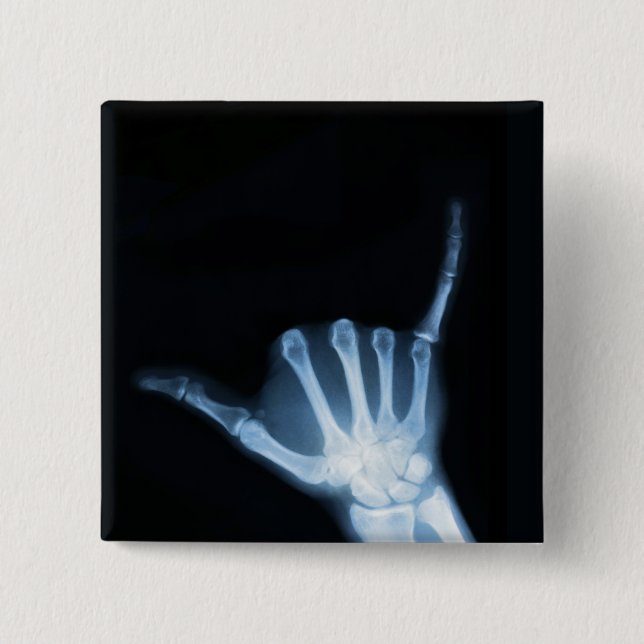 Shaka Sign X-Ray (Hang Loose) 15 Cm Square Badge (Front)