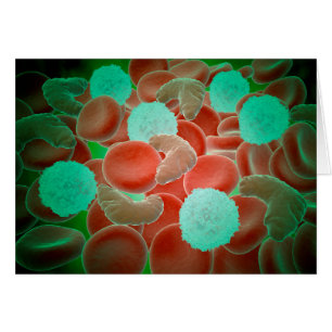 Sickle Cell Anaemia With Red Blood Cells