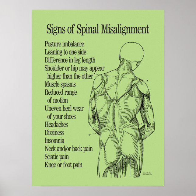 Signs of Spinal Misalignment Chiropractic Poster (Front)