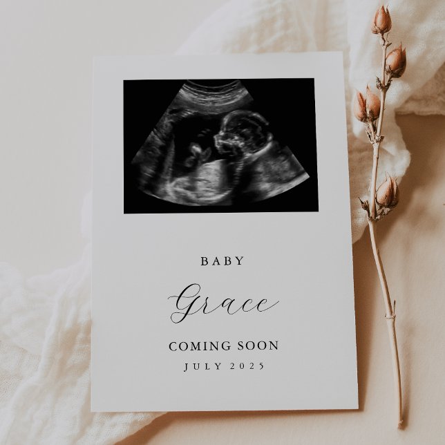 Simple Ultrasound Photo Baby Announcement Card (Creator Uploaded)