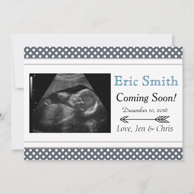 Simple Unisex Ultrasound Baby Announcement (Front)
