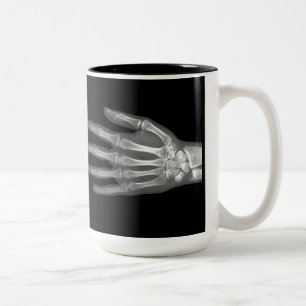 Skeleton Hand X-Ray Mug