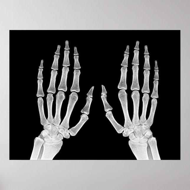Skeleton Hands Xray Picture Human Anatomy photo  Poster (Front)