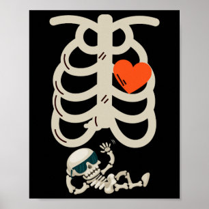 Skeleton Pregnancy Announcement X-ray Halloween Poster