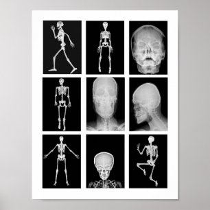 skeleton Skull Human Body XRAYS Collage art Poster