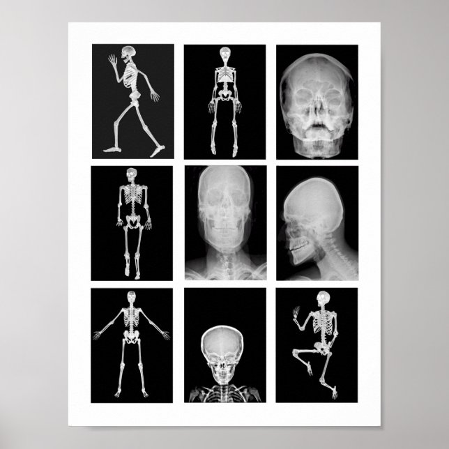 skeleton Skull Human Body XRAYS Collage art Poster (Front)