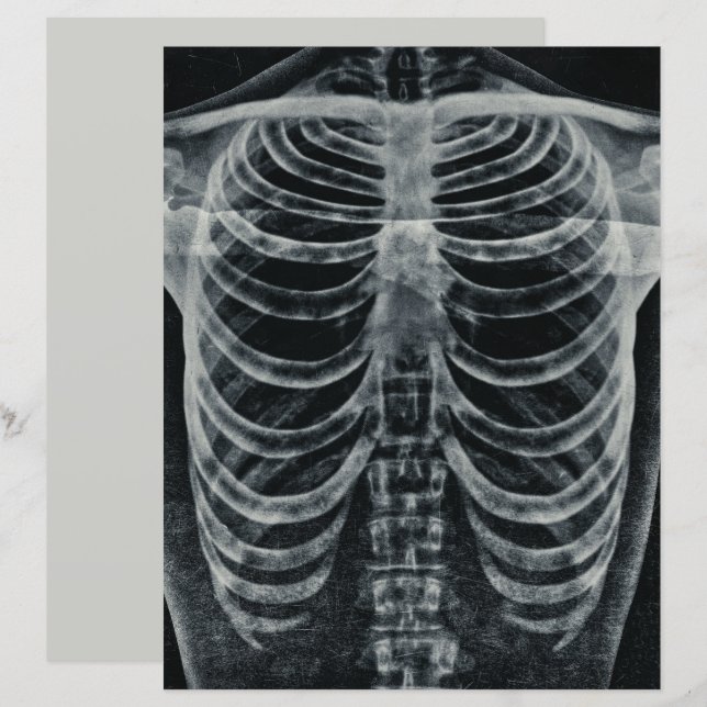 Skeleton Xray Rib Cage Vintage Black White Gothic (Front/Back)