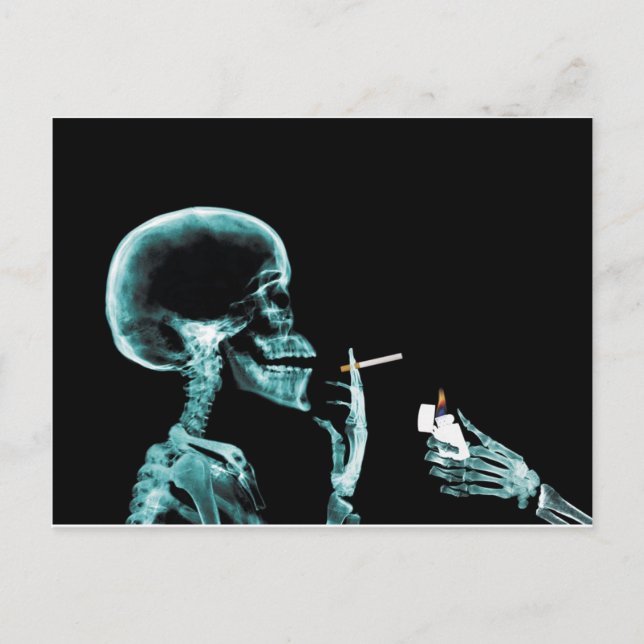 smoking x-rays postcard (Front)