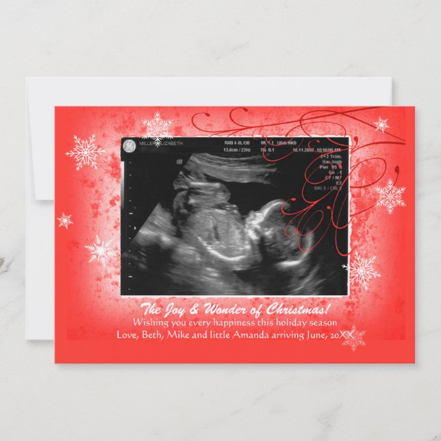 Snowflakes Ultrasound Holiday Card (Front)