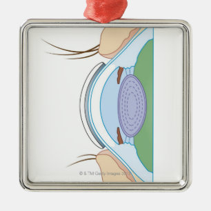 Soft Contact Lens Metal Ornament
