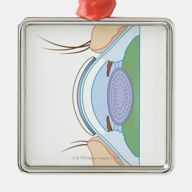 Soft Contact Lens Metal Ornament (Front)