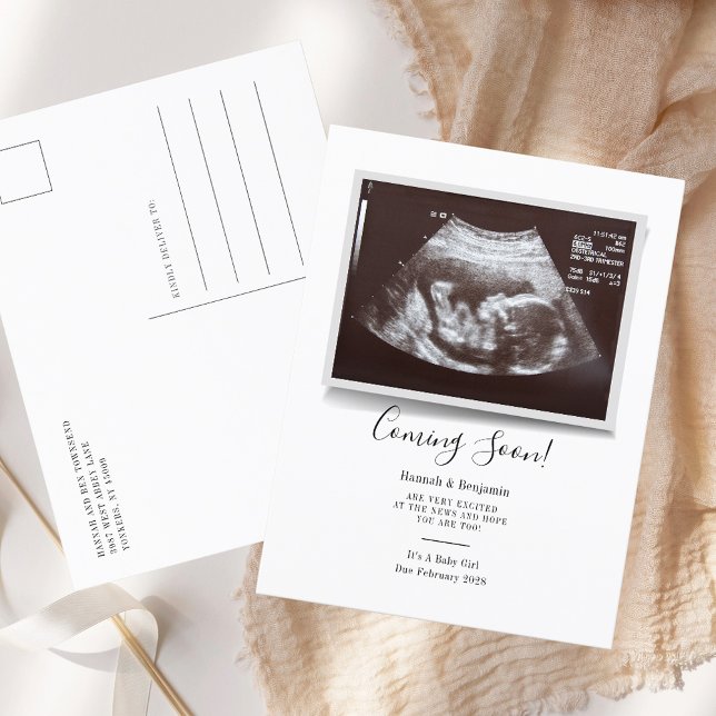 Sonogram Baby Scan Ultrasound Pregnancy Announcement Postcard (Sonogram Baby Scan Ultrasound Pregnancy Announcement Postcard)
