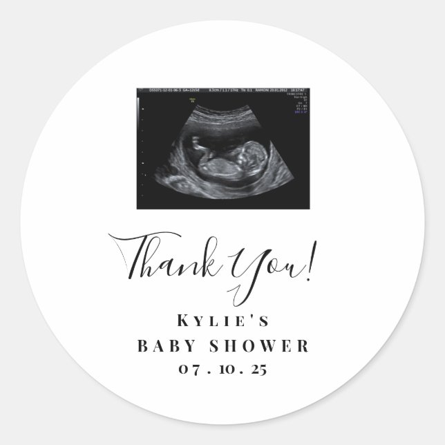 Sonogram Baby Shower Stickers (Front)