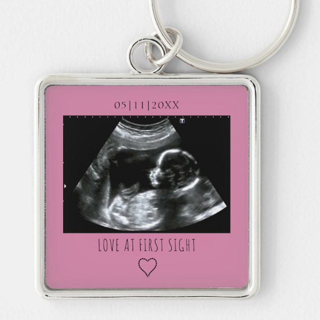 Sonogram Picture Photo Gift Baby Ultrasound Pink Key Ring (Front)