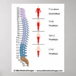 Spinal cord injury levels, labelled drawing. poster