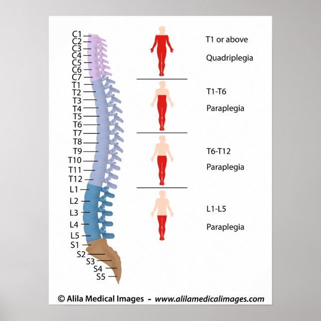 Spinal cord injury levels, labelled drawing. poster (Front)