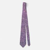 Spindle melanoma necktie