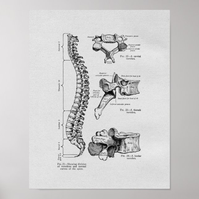 Spine and Vertebrae Vintage Print (Front)