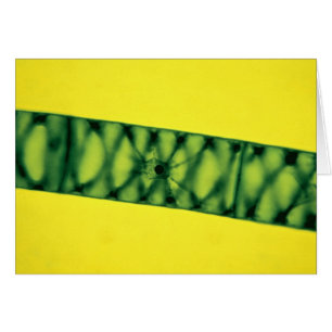 Spirogyra Green Algae