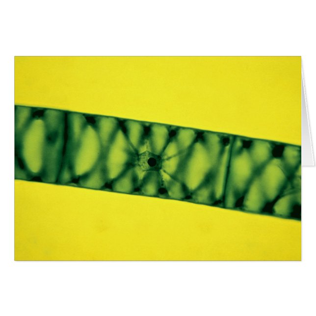 Spirogyra Green Algae (Front Horizontal)