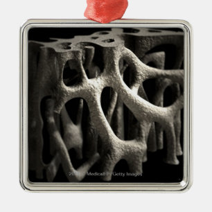 Structure of a bone with osteoporosis metal ornament