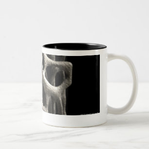 Structure of a bone with osteoporosis Two-Tone coffee mug