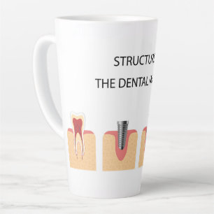 Structure of the dental implant latte mug
