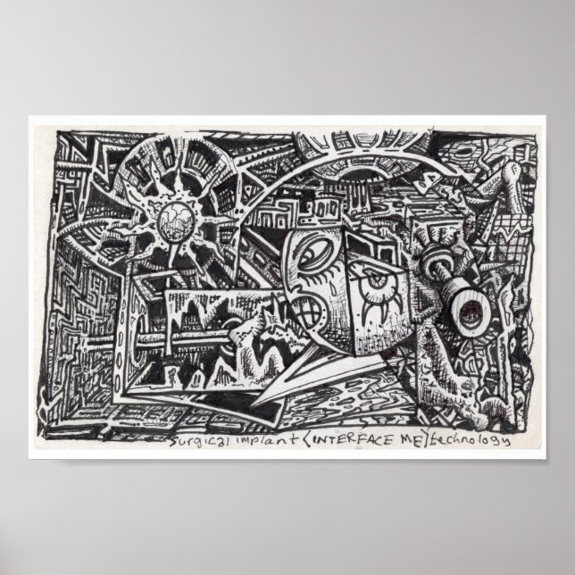 Surgical Implant (Interface Me) Technology. Poster (Front)