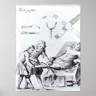 Surgical operation to amputate a leg poster
