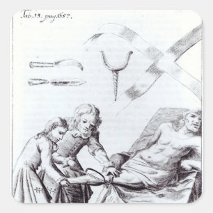 Surgical operation to amputate a leg square sticker