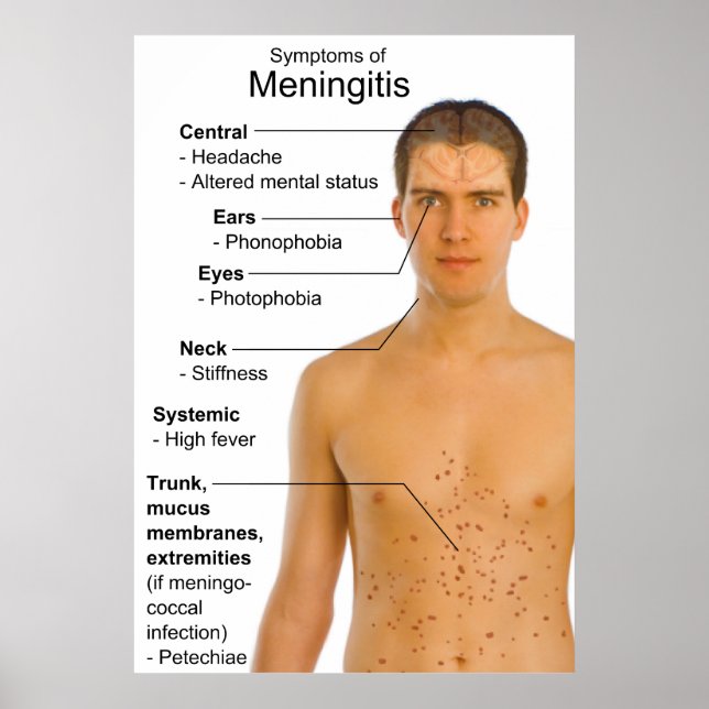 Symptoms Chart of Inflammation Disease Meningitis (Front)