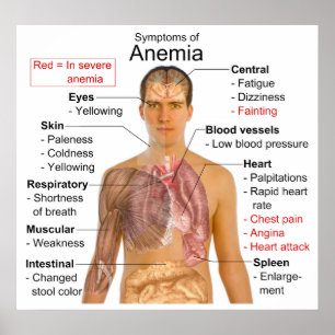 Symptoms Chart of the Blood Disease Anaemia