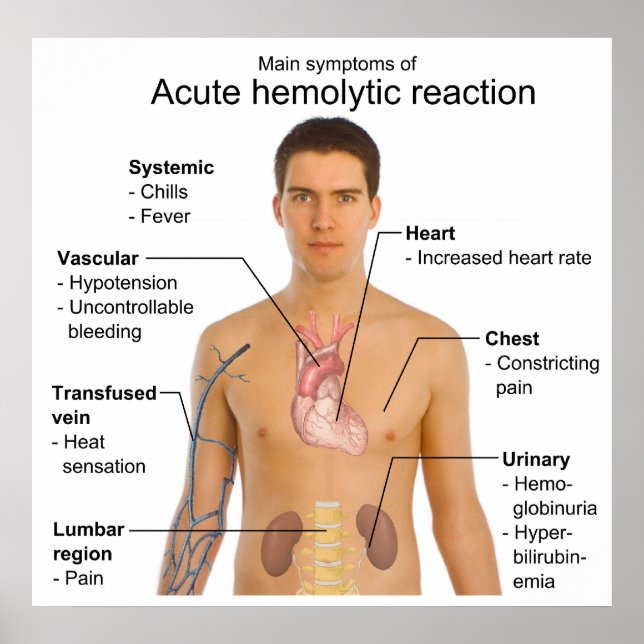 Symptoms of Acute Hemolytic Transfusion Reaction Poster (Front)