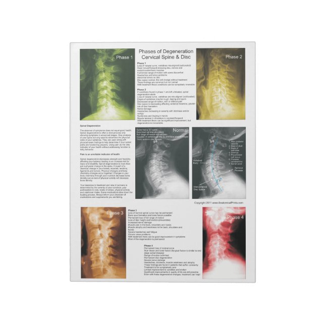 Tear Off Pad Cervical Spinal Degeneration (Rotated)