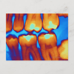 Teeth with fillings (green), coloured X-ray. Postcard