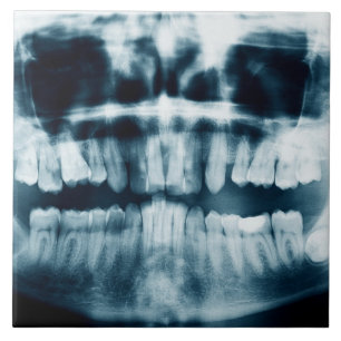 Teeth X-ray Ceramic Tile