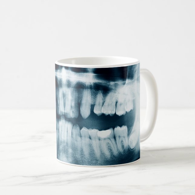 Teeth X-ray Coffee Mug (Front Right)