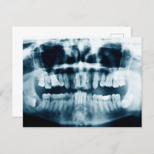 Teeth X-ray Postcard