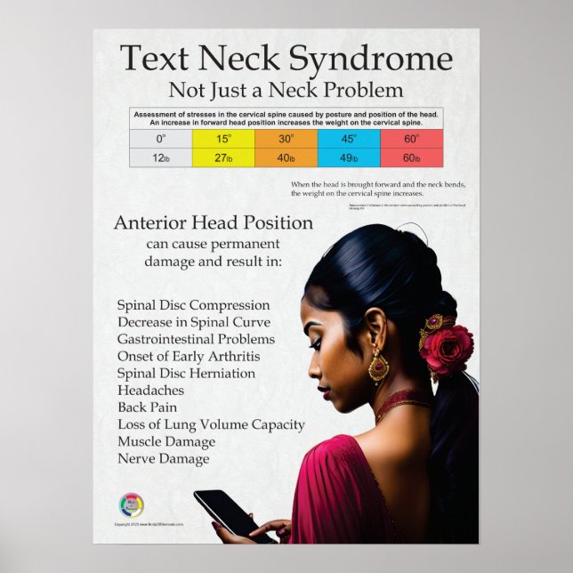 Text Neck Pain Syndrome Chart (Front)