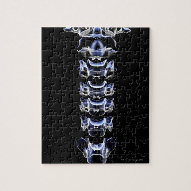 The Cervical Vertebrae Jigsaw Puzzle (Vertical)