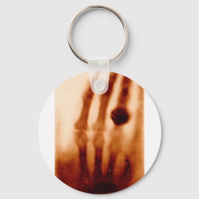 The First X-Ray, 1901, Photograph Key Ring (Front)
