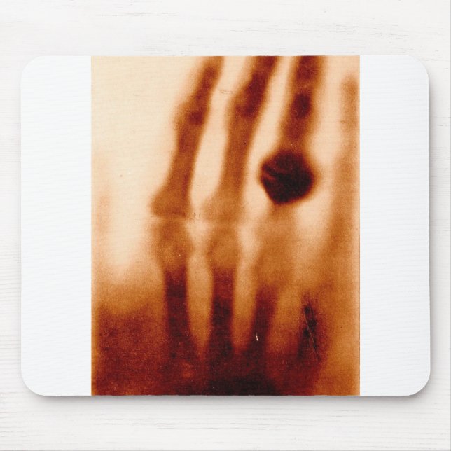 The First X-Ray, 1901, Photograph Mouse Pad (Front)